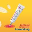 Kamistad Gel bei Zahnfleischentz&uuml;ndungen und Aphten - 4