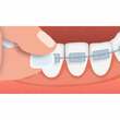 GUM Ortho Wachs mint - 4