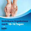 Duofilm Vereisungsspray gegen Warzen - 7