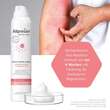 Allpresan atopix Schaumcreme f&uuml;r juckende, ger&ouml;tete, trockene Haut - 4