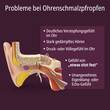 Evolsin Anti-Ohrenschmalz Ohrenschmalz Entferner - 7