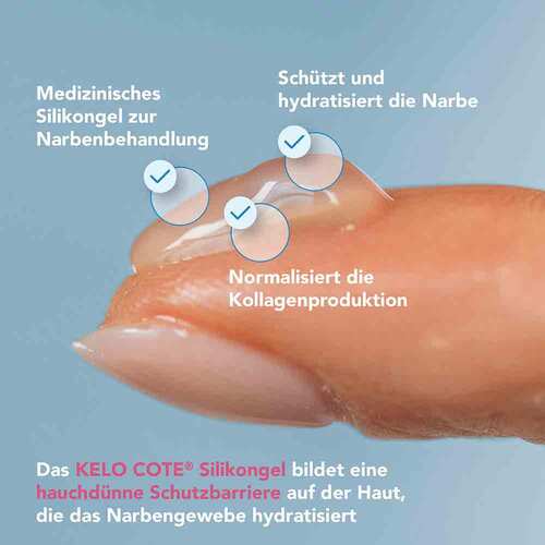 KELO-COTE® Narbengel - 4