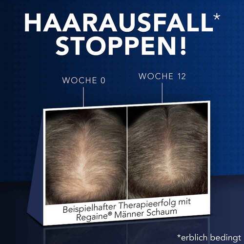 REGAINE® M&auml;nner L&ouml;sung - 3