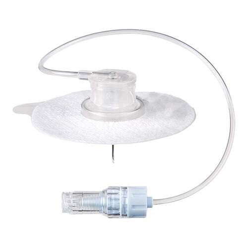 Ambix Intrastick Safe 20 Gx20 mm druckfest - 1