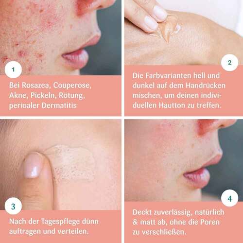 Benevi Color Pigmentcreme dunkel - 5