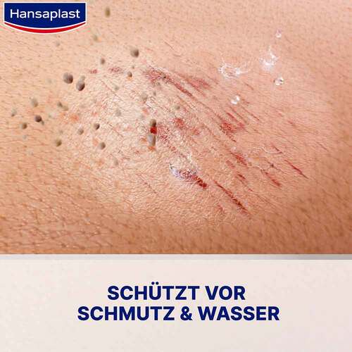 Hansaplast Zweite Haut Schutz Spr&uuml;h-Pflaster - 3
