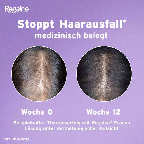 Regaine Frauen Schaum 50 mg/g  - 5