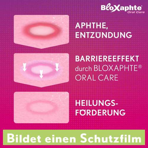 BloXaphte® Oral Care Mundsp&uuml;lung bei Aphthen und Verletzungen im Mund - 4