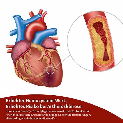 Beh Arterie + Kapseln - 6