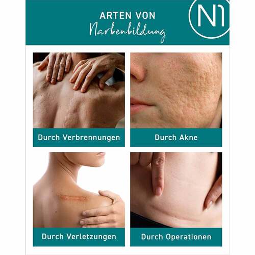 N1 Narben Gel - 5