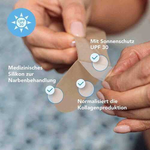 Kelo-Cote Silikon-Narbenpflaster Kaiserschnitt - 4