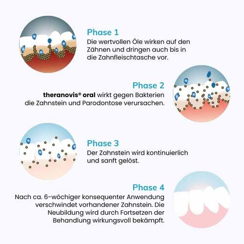 Theranovis oral Zahnstein Spray - 3