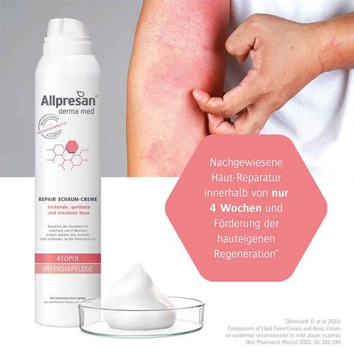 Allpresan atopix Schaumcreme f&uuml;r juckende, ger&ouml;tete, trockene Haut - 4