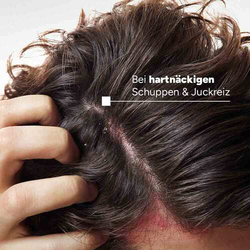 Ducray Kelual Elution Begleitpflege-Shampoo - 2